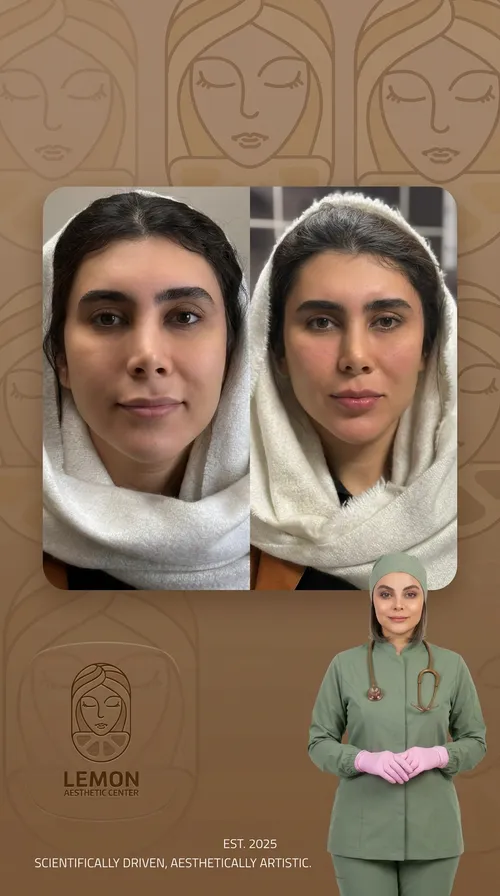 نتیجهٔ درمان، قبل و بعد در کلینیک زیبایی لمون