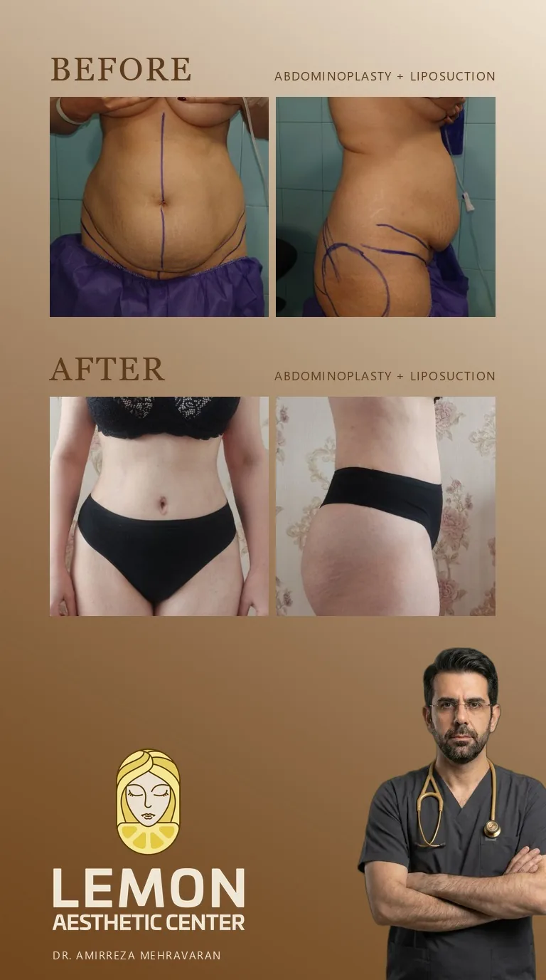 جراحی زیبایی و پیکرتراشی
